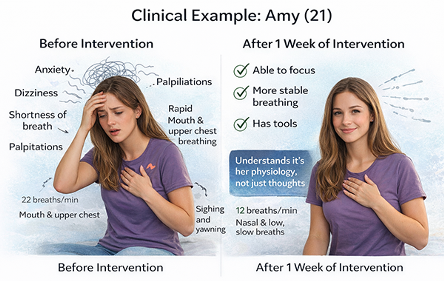 BradCliff suggests that not only does breathing well reduce anxiety, but it also alters the mechanism driving anxiety, which is known as dysfunctional breathing. Therefore, how we breathe doesn’t just reduce anxiety: it may be driving it.