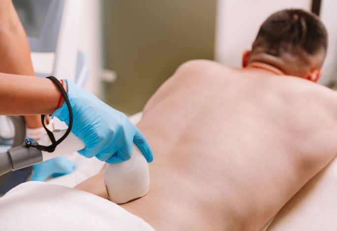 laser hair removal for men