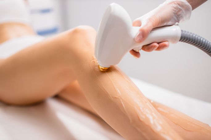 laser hair removal richmond nelson