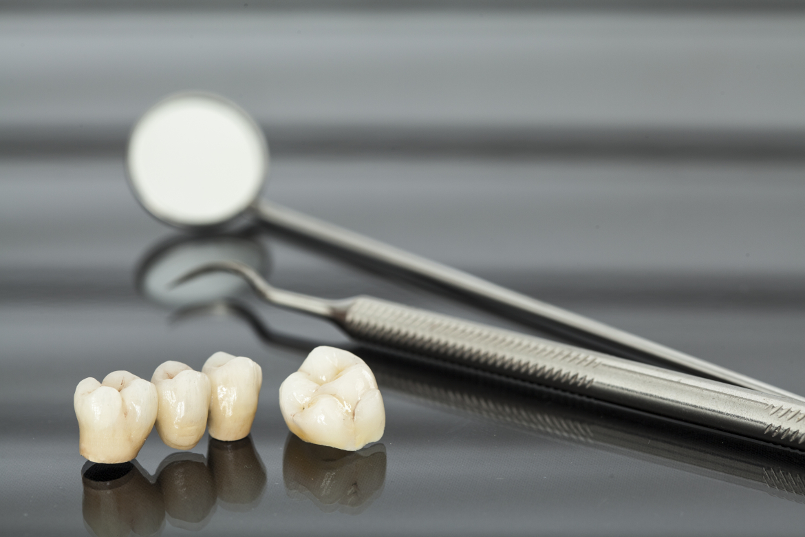 What is a dental crown? Crowns by RIchmond Dental Centre
